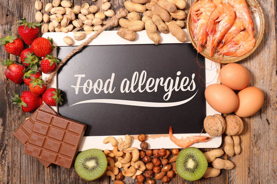 Common food allergens